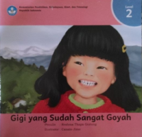 Image of Gigi yang Sudah Sangat Goyah